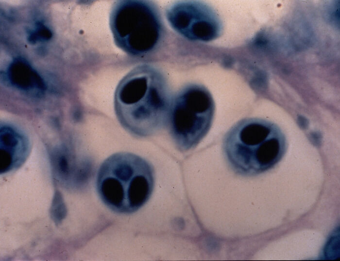 13 Insanely Small Creatures Competing For “Smallest Animal In The World” Title