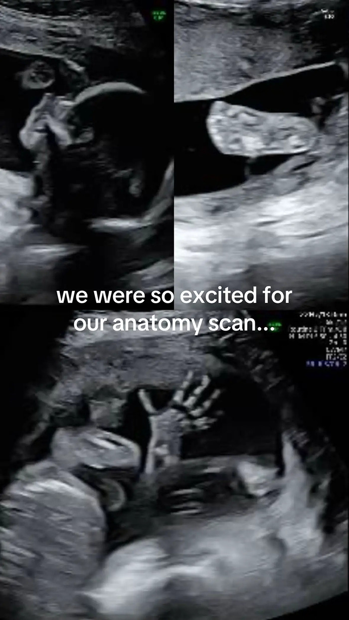 Pregnant Woman’s Sonogram Image Goes Viral After She Spots Hilarious Detail Pregnant Woman’s Sonogram Image Goes Viral After She Spots Hilarious Detail
