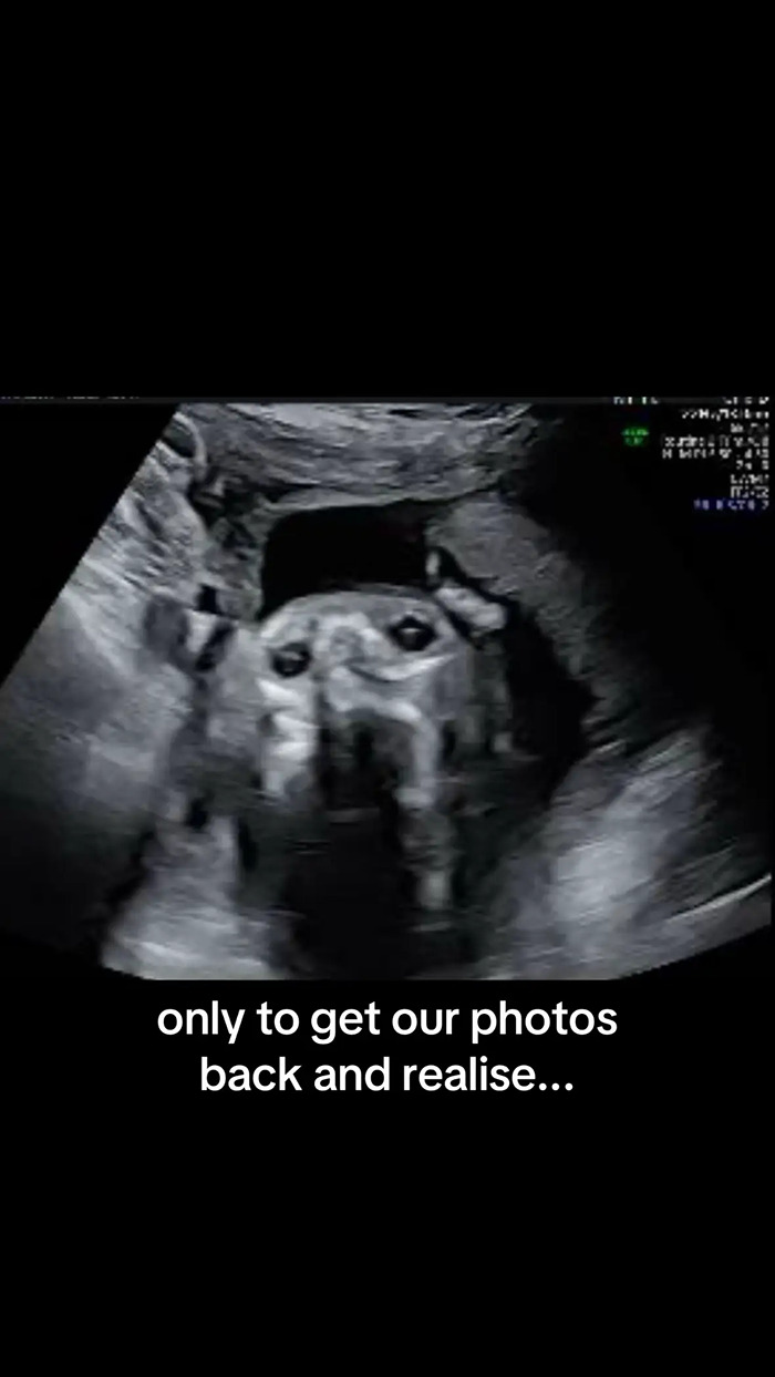Pregnant Woman’s Sonogram Image Goes Viral After She Spots Hilarious Detail Pregnant Woman’s Sonogram Image Goes Viral After She Spots Hilarious Detail