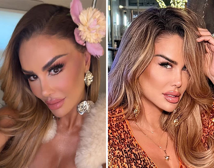 “Risking Blindness”: Actress Reveals She Had Controversial Surgery To Change Her Eye Color “Risking Blindness”: Actress Reveals She Had Controversial Surgery To Change Her Eye Color