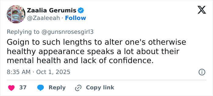 “Risking Blindness”: Actress Reveals She Had Controversial Surgery To Change Her Eye Color “Risking Blindness”: Actress Reveals She Had Controversial Surgery To Change Her Eye Color