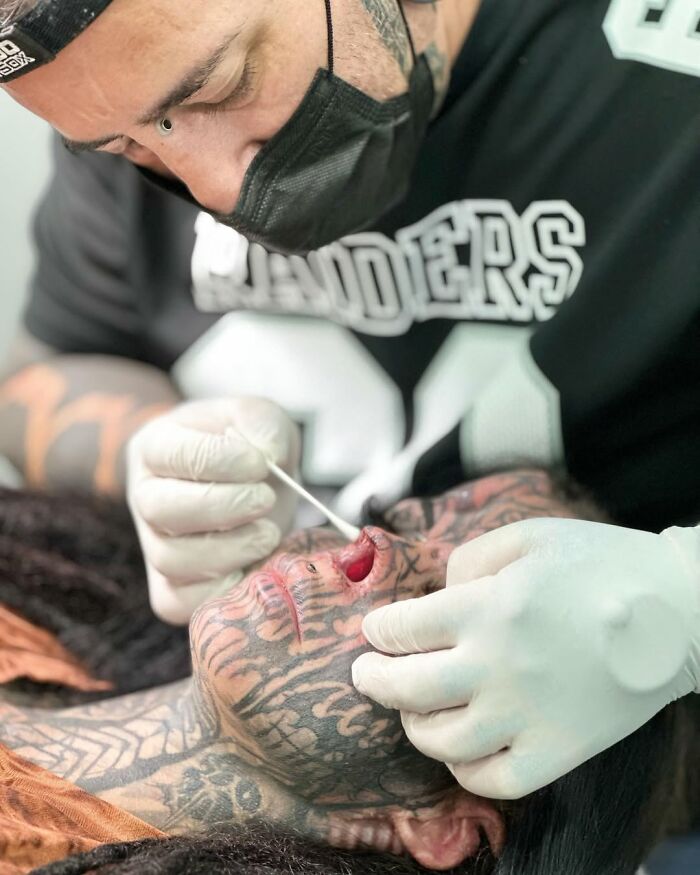 Woman Who Cut Her Nose Off Shares Shocking Before-And-After Pics Woman Who Cut Her Nose Off Shares Shocking Before-And-After Pics