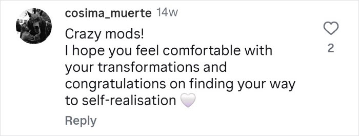 Woman Who Cut Her Nose Off Shares Shocking Before-And-After Pics Woman Who Cut Her Nose Off Shares Shocking Before-And-After Pics