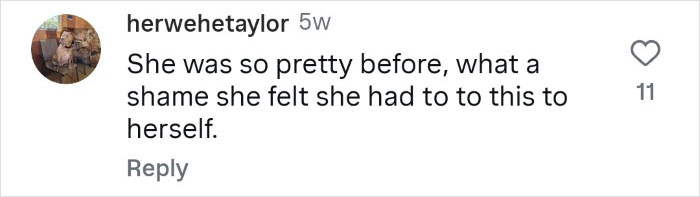 Woman Who Cut Her Nose Off Shares Shocking Before-And-After Pics Woman Who Cut Her Nose Off Shares Shocking Before-And-After Pics