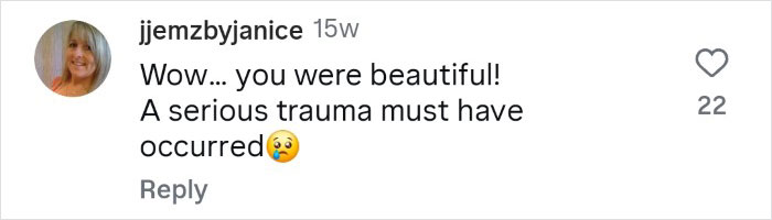 Woman Who Cut Her Nose Off Shares Shocking Before-And-After Pics Woman Who Cut Her Nose Off Shares Shocking Before-And-After Pics