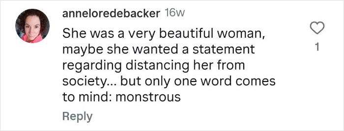 Woman Who Cut Her Nose Off Shares Shocking Before-And-After Pics Woman Who Cut Her Nose Off Shares Shocking Before-And-After Pics