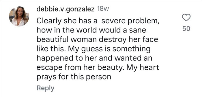 Woman Who Cut Her Nose Off Shares Shocking Before-And-After Pics Woman Who Cut Her Nose Off Shares Shocking Before-And-After Pics