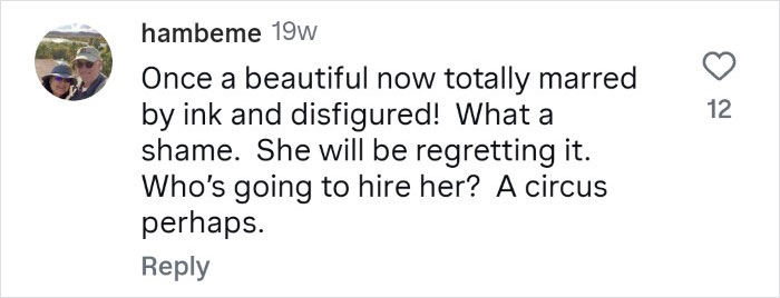 Woman Who Cut Her Nose Off Shares Shocking Before-And-After Pics Woman Who Cut Her Nose Off Shares Shocking Before-And-After Pics