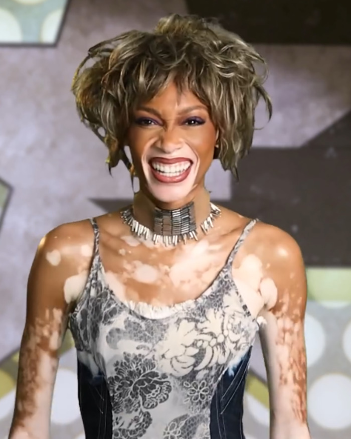 Winnie Harlow Breaks Silence After Massive Backlash Over ‘Disrespectful’ Whitney Houston Halloween Look Winnie Harlow Breaks Silence After Massive Backlash Over ‘Disrespectful’ Whitney Houston Halloween Look
