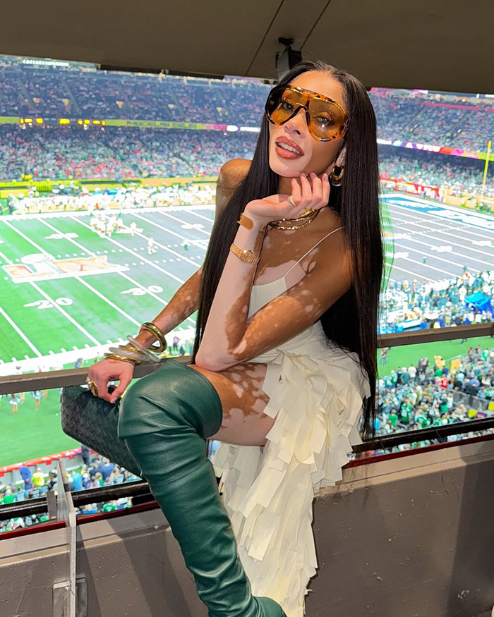 Winnie Harlow Breaks Silence After Massive Backlash Over ‘Disrespectful’ Whitney Houston Halloween Look Winnie Harlow Breaks Silence After Massive Backlash Over ‘Disrespectful’ Whitney Houston Halloween Look