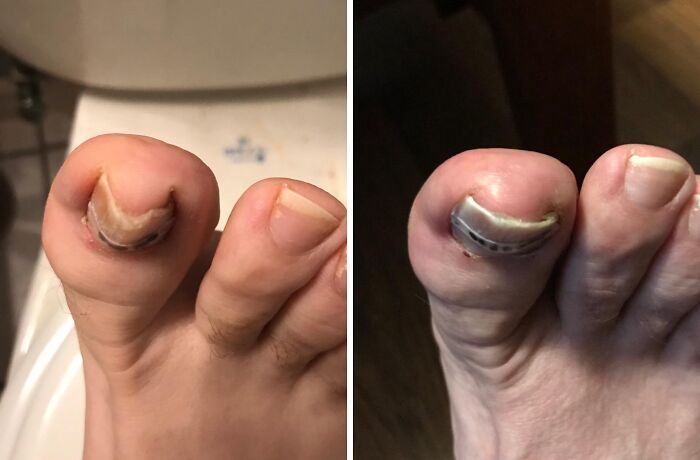 22 Genius Products That Will Solve Your Most Embarrassing Winter Beauty Problems 22 Genius Products That Will Solve Your Most Embarrassing Winter Beauty Problems