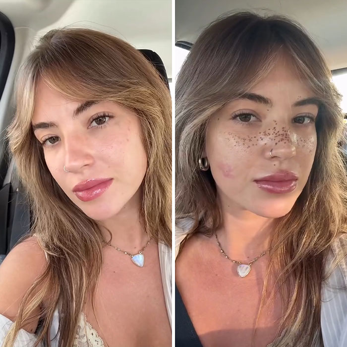 “What Is Wrong With You People?”: Woman Who Dreamed Of Having Freckles Gets Them Tattooed On Face “What Is Wrong With You People?”: Woman Who Dreamed Of Having Freckles Gets Them Tattooed On Face