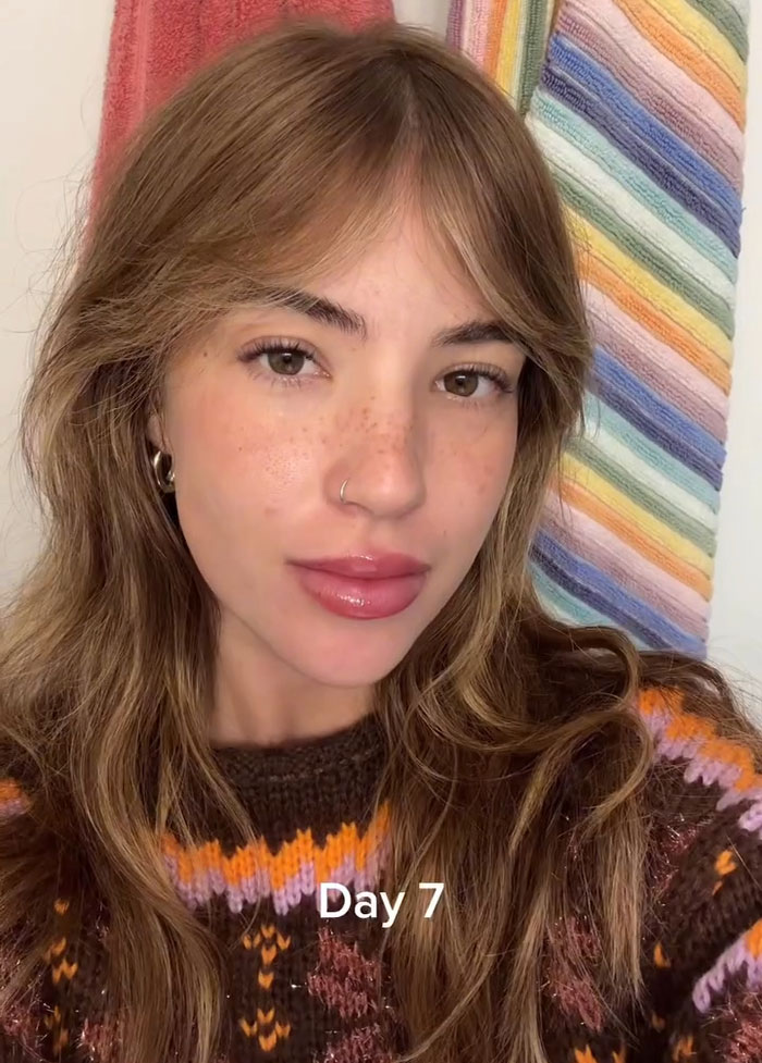 “What Is Wrong With You People?”: Woman Who Dreamed Of Having Freckles Gets Them Tattooed On Face “What Is Wrong With You People?”: Woman Who Dreamed Of Having Freckles Gets Them Tattooed On Face