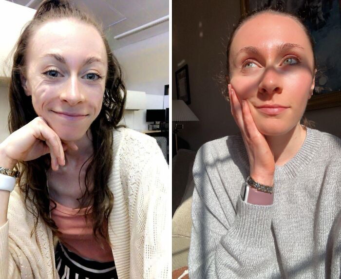 92 Stunning Before-And-Afters That Prove Anyone Can Completely Reinvent Themselves 92 Stunning Before-And-Afters That Prove Anyone Can Completely Reinvent Themselves