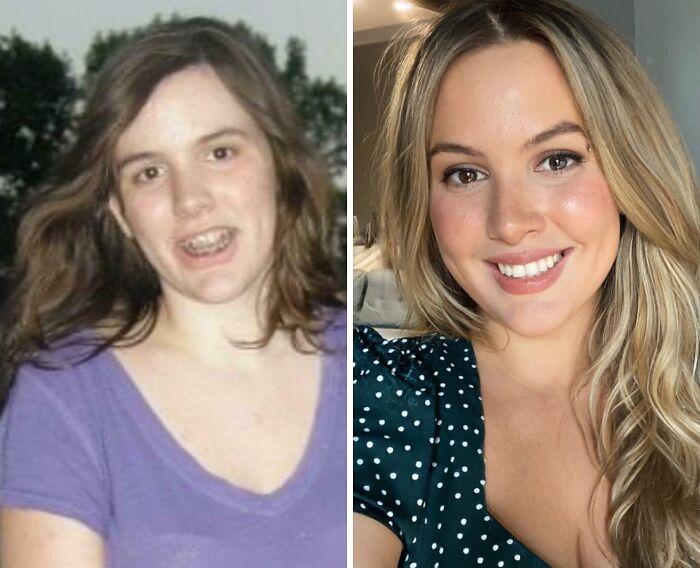 92 Stunning Before-And-Afters That Prove Anyone Can Completely Reinvent Themselves 92 Stunning Before-And-Afters That Prove Anyone Can Completely Reinvent Themselves