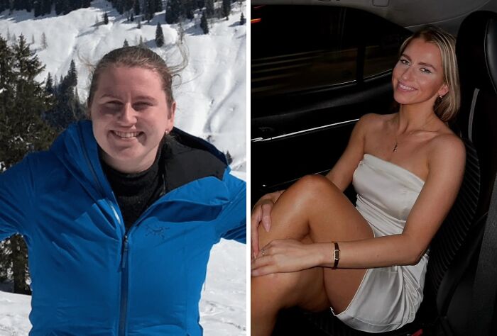 92 Stunning Before-And-Afters That Prove Anyone Can Completely Reinvent Themselves 92 Stunning Before-And-Afters That Prove Anyone Can Completely Reinvent Themselves