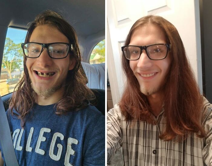 92 Stunning Before-And-Afters That Prove Anyone Can Completely Reinvent Themselves 92 Stunning Before-And-Afters That Prove Anyone Can Completely Reinvent Themselves