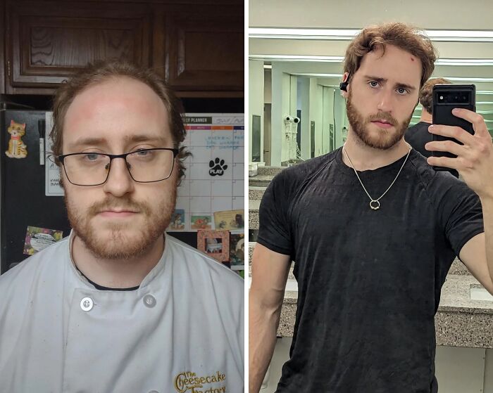 92 Stunning Before-And-Afters That Prove Anyone Can Completely Reinvent Themselves 92 Stunning Before-And-Afters That Prove Anyone Can Completely Reinvent Themselves