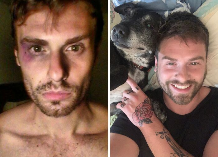 92 Stunning Before-And-Afters That Prove Anyone Can Completely Reinvent Themselves 92 Stunning Before-And-Afters That Prove Anyone Can Completely Reinvent Themselves