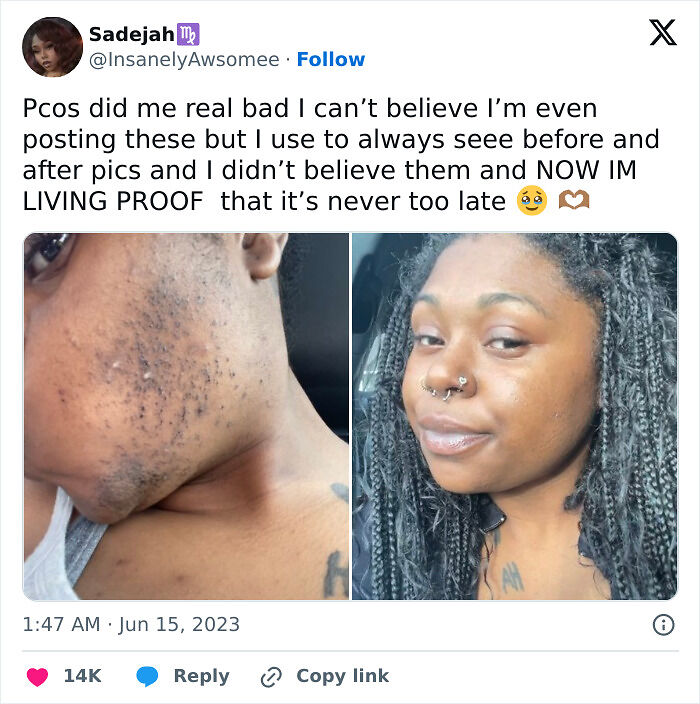 92 Stunning Before-And-Afters That Prove Anyone Can Completely Reinvent Themselves 92 Stunning Before-And-Afters That Prove Anyone Can Completely Reinvent Themselves