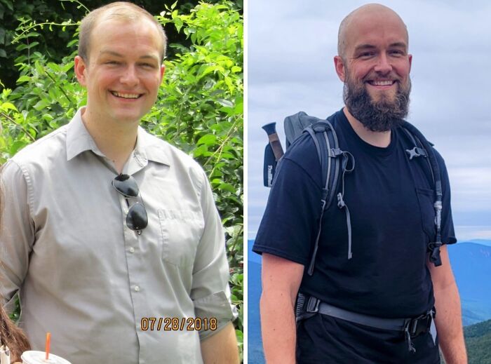 92 Stunning Before-And-Afters That Prove Anyone Can Completely Reinvent Themselves 92 Stunning Before-And-Afters That Prove Anyone Can Completely Reinvent Themselves