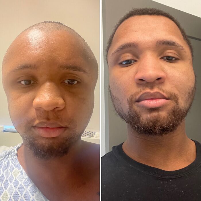 92 Stunning Before-And-Afters That Prove Anyone Can Completely Reinvent Themselves 92 Stunning Before-And-Afters That Prove Anyone Can Completely Reinvent Themselves