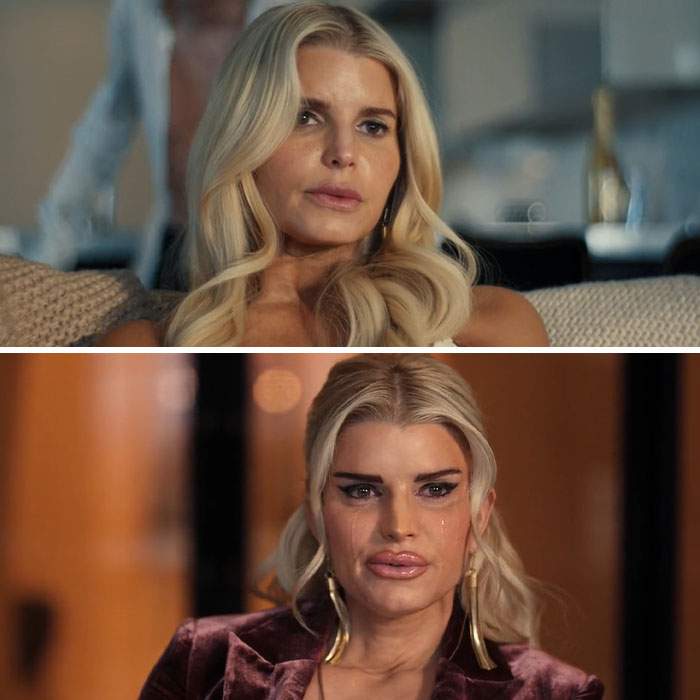Jessica Simpson’s Botched Plastic Surgery For ‘All’s Fair’ Role Stuns Fans In Acting Return Jessica Simpson’s Botched Plastic Surgery For ‘All’s Fair’ Role Stuns Fans In Acting Return
