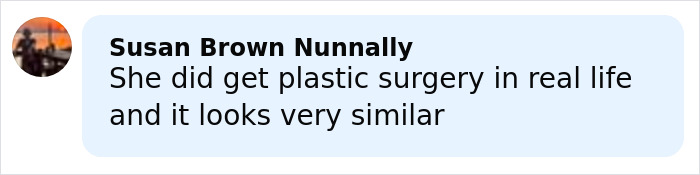 Jessica Simpson’s Botched Plastic Surgery For ‘All’s Fair’ Role Stuns Fans In Acting Return Jessica Simpson’s Botched Plastic Surgery For ‘All’s Fair’ Role Stuns Fans In Acting Return