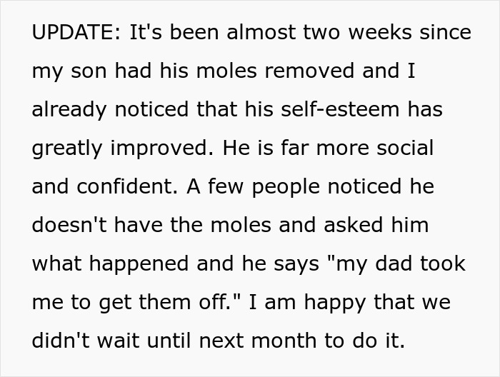 Mom Outraged As Dad Approves 12YO Son’s Mole Removal Without Asking, Calls It Cosmetic Surgery Mom Outraged As Dad Approves 12YO Son’s Mole Removal Without Asking, Calls It Cosmetic Surgery