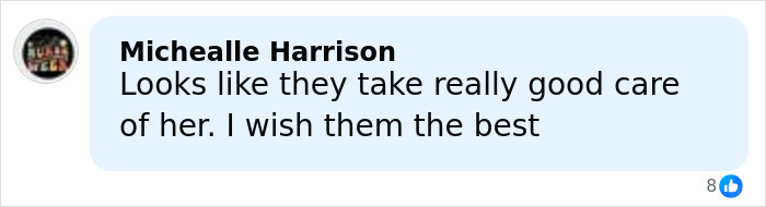 Woman Born Without Most Of Her Brain Turns 20, Family Speaks Out And It Sparks A Heated Debate Woman Born Without Most Of Her Brain Turns 20, Family Speaks Out And It Sparks A Heated Debate