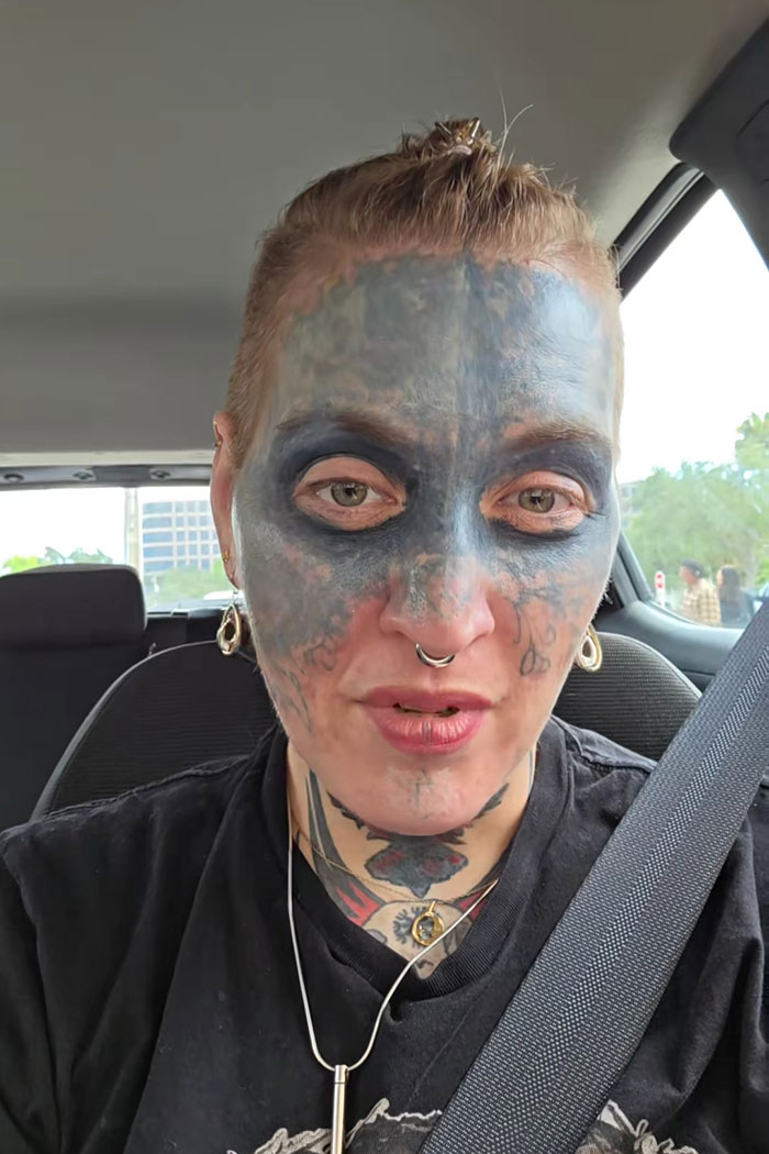Brave Woman Shares Story Of Removing Unwanted Face Tattoo After Cruel Prank Brave Woman Shares Story Of Removing Unwanted Face Tattoo After Cruel Prank