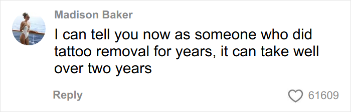 Brave Woman Shares Story Of Removing Unwanted Face Tattoo After Cruel Prank Brave Woman Shares Story Of Removing Unwanted Face Tattoo After Cruel Prank