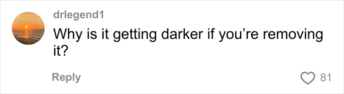 Brave Woman Shares Story Of Removing Unwanted Face Tattoo After Cruel Prank Brave Woman Shares Story Of Removing Unwanted Face Tattoo After Cruel Prank