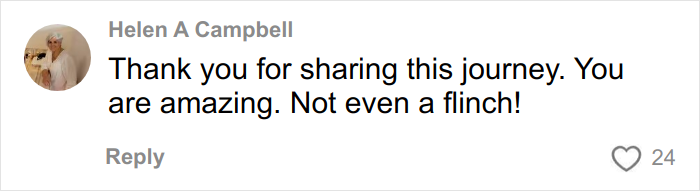 Brave Woman Shares Story Of Removing Unwanted Face Tattoo After Cruel Prank Brave Woman Shares Story Of Removing Unwanted Face Tattoo After Cruel Prank