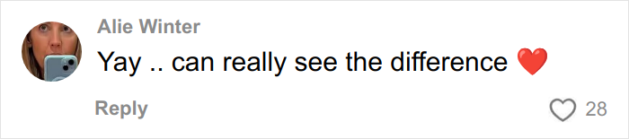 Brave Woman Shares Story Of Removing Unwanted Face Tattoo After Cruel Prank Brave Woman Shares Story Of Removing Unwanted Face Tattoo After Cruel Prank