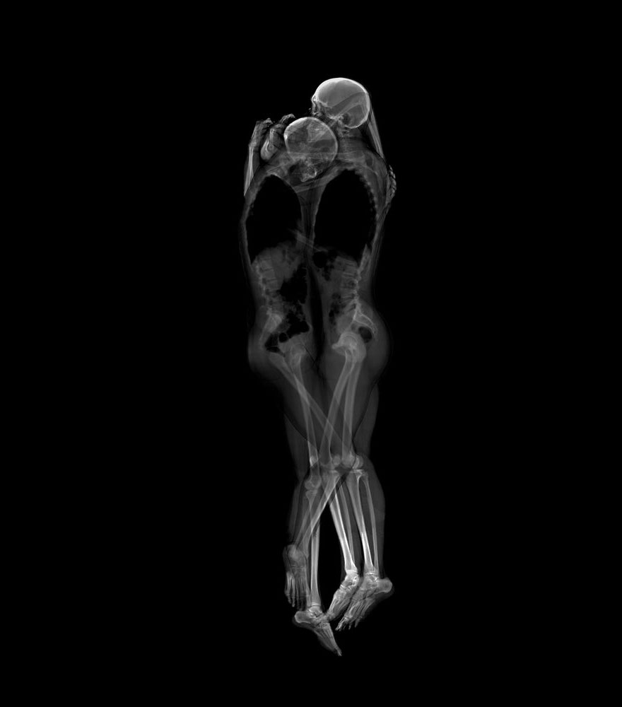 Intimate X-Ray Portraits of Couples by Ayako Kanda and Mayuka Hayashi Intimate X-Ray Portraits of Couples by Ayako Kanda and Mayuka Hayashi
