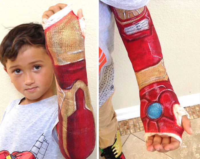Creative Cast Art That Makes The Best Of A Bad Situation Creative Cast Art That Makes The Best Of A Bad Situation