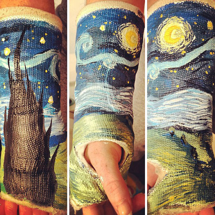 Creative Cast Art That Makes The Best Of A Bad Situation Creative Cast Art That Makes The Best Of A Bad Situation