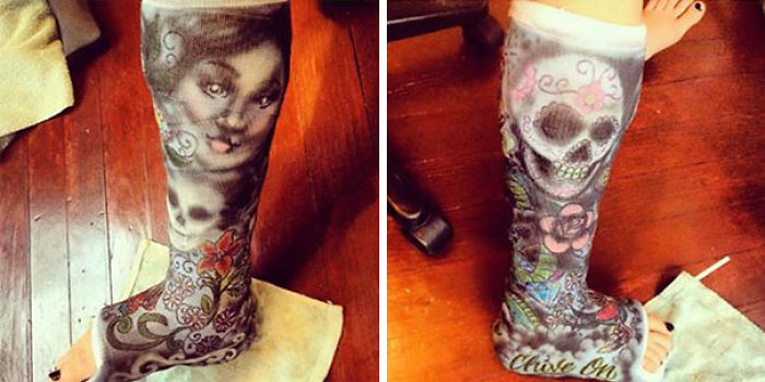 Creative Cast Art That Makes The Best Of A Bad Situation Creative Cast Art That Makes The Best Of A Bad Situation