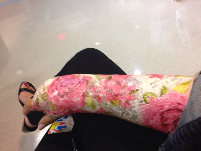 Creative Cast Art That Makes The Best Of A Bad Situation Creative Cast Art That Makes The Best Of A Bad Situation