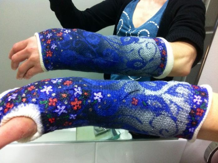 Creative Cast Art That Makes The Best Of A Bad Situation Creative Cast Art That Makes The Best Of A Bad Situation