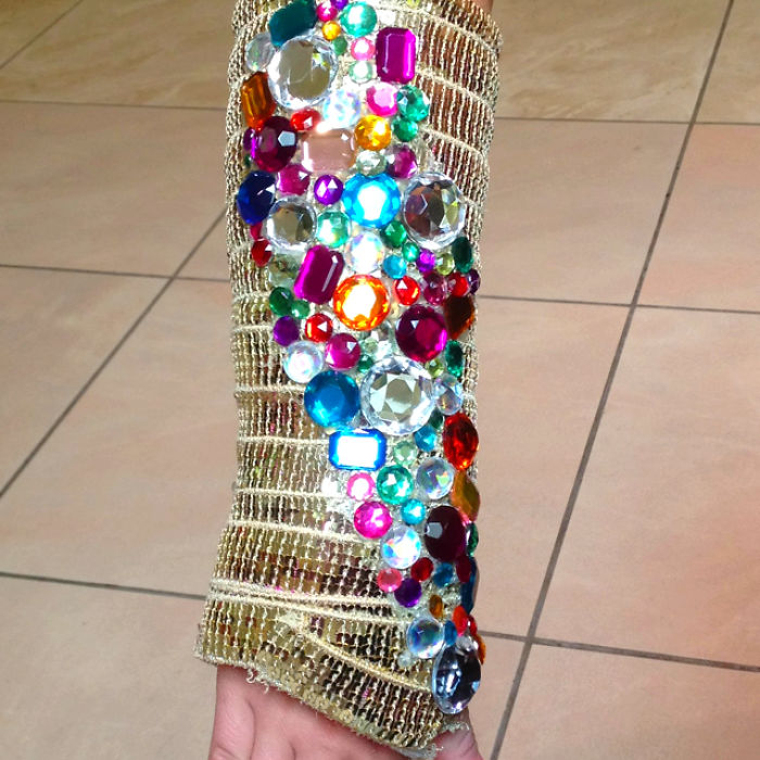 Creative Cast Art That Makes The Best Of A Bad Situation Creative Cast Art That Makes The Best Of A Bad Situation