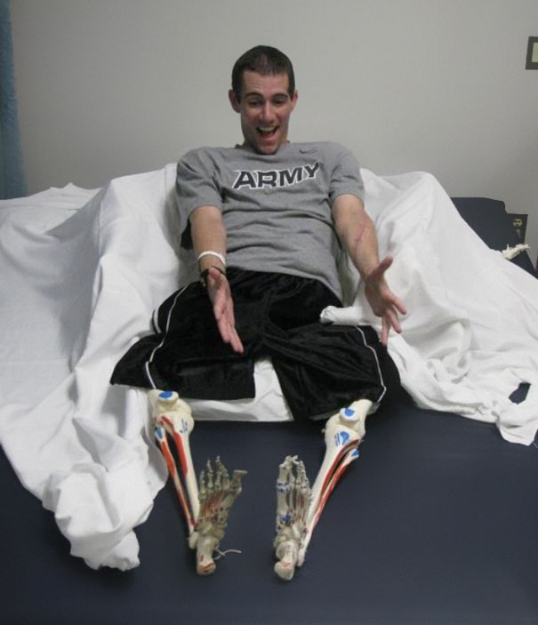 15 Amputees With A Brilliant Sense Of Humor