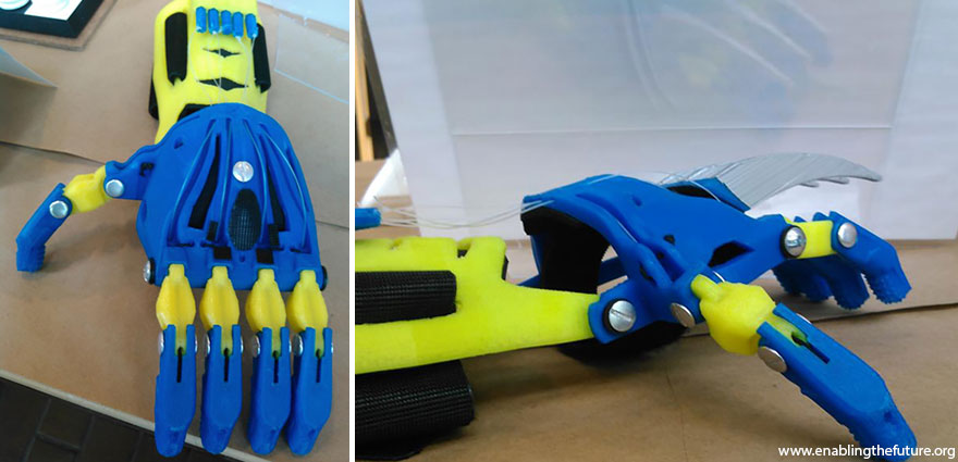 Volunteer Engineers 3D-Print Superhero Prosthetic Arms For Kids Volunteer Engineers 3D-Print Superhero Prosthetic Arms For Kids