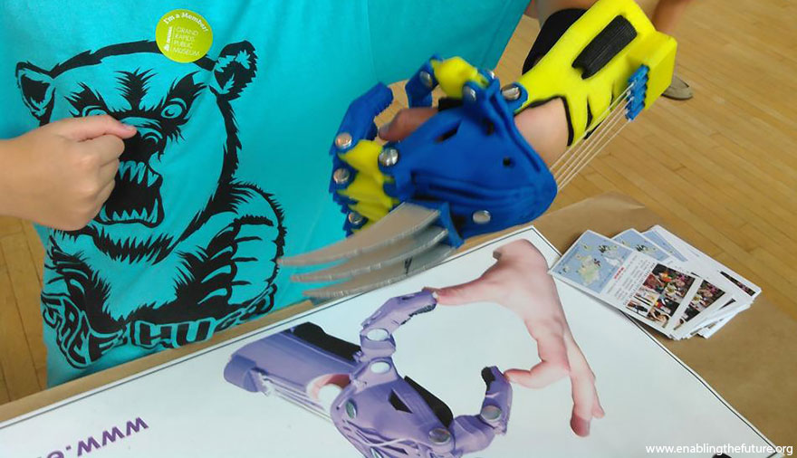 Volunteer Engineers 3D-Print Superhero Prosthetic Arms For Kids Volunteer Engineers 3D-Print Superhero Prosthetic Arms For Kids