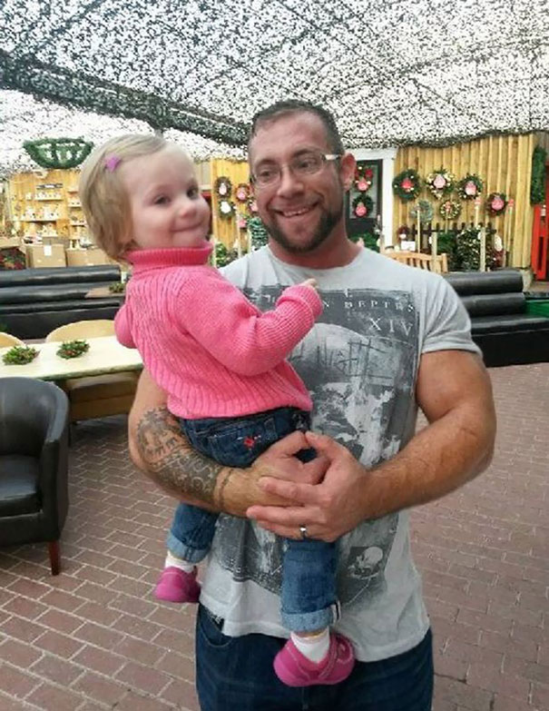 Parents Tattoo Their Legs With Daughter&#8217;s Birthmark So She Won&#8217;t Feel Different