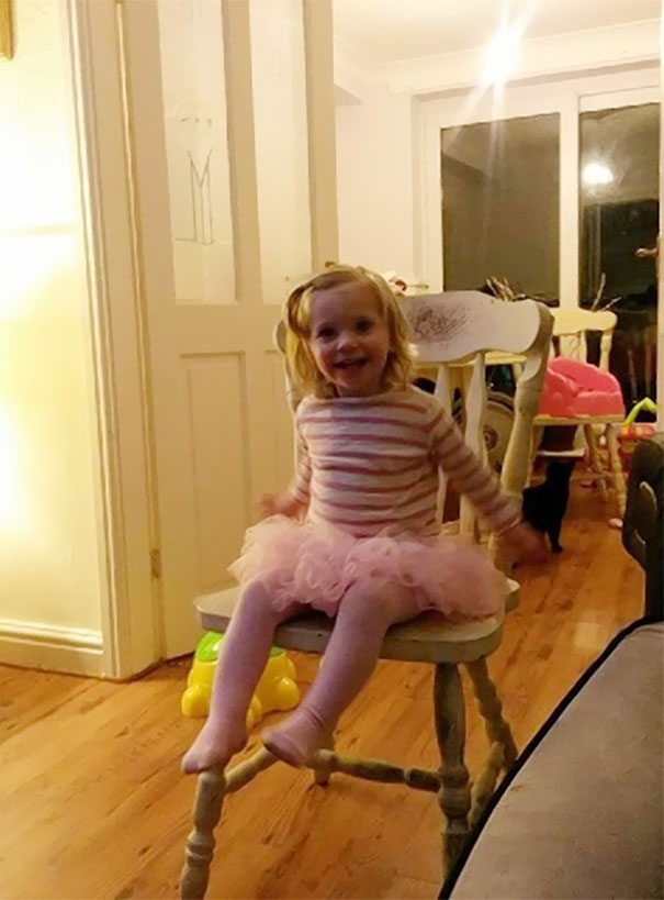 Parents Tattoo Their Legs With Daughter&#8217;s Birthmark So She Won&#8217;t Feel Different