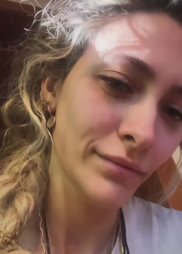 “It Ruined My Life”: Paris Jackson Reveals How Substance Use Deformed Her Face