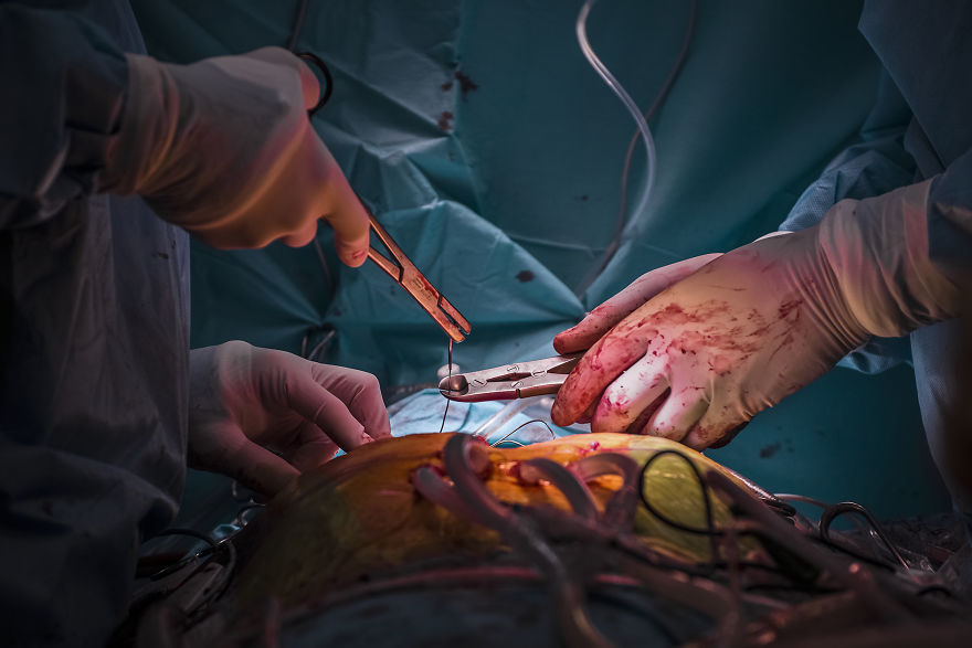 Gentle Violence: A Visual Exploration Of The Body During Open Heart Surgeries Gentle Violence: A Visual Exploration Of The Body During Open Heart Surgeries