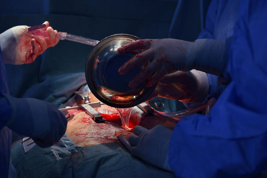 Gentle Violence: A Visual Exploration Of The Body During Open Heart Surgeries Gentle Violence: A Visual Exploration Of The Body During Open Heart Surgeries